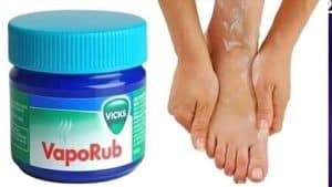 Vicks